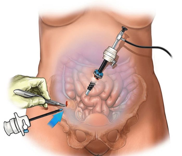 untitled design 3 compressed 1 1